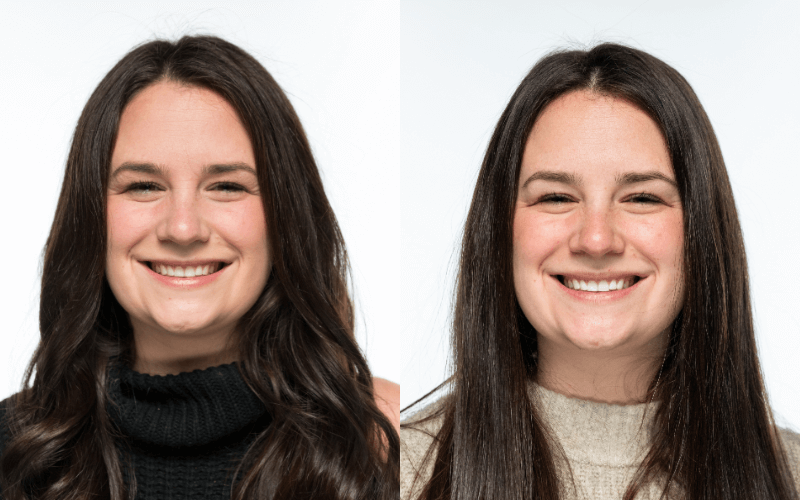 Heather's smile before and after using Ultra Teeth Whitening Strips